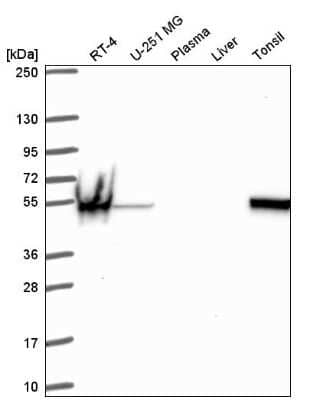 Western Blot: SPTLC1 Antibody [NBP2-56477]