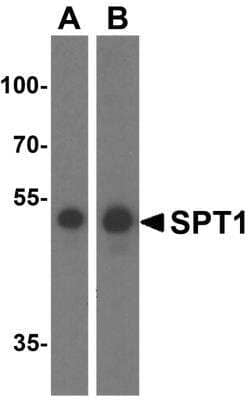 Western Blot: SPTLC1 AntibodyBSA Free [NBP2-81928]