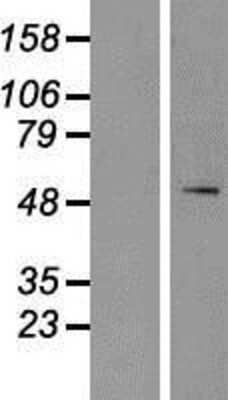 Western Blot: SPTLC1 Overexpression Lysate [NBP2-07622]