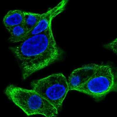 Immunocytochemistry/ Immunofluorescence: SPTLC3 Antibody [NBP2-54899]