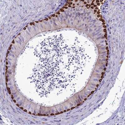Immunohistochemistry-Paraffin: SPTLC3 Antibody [NBP2-33418]