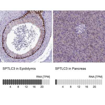 Immunohistochemistry-Paraffin: SPTLC3 Antibody [NBP2-33418]