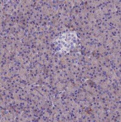 Immunohistochemistry-Paraffin: SPTLC3 Antibody [NBP2-33418]