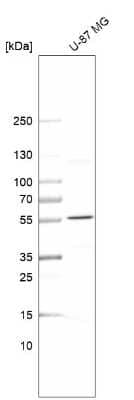 Western Blot: SPTLC3 Antibody [NBP2-54899]