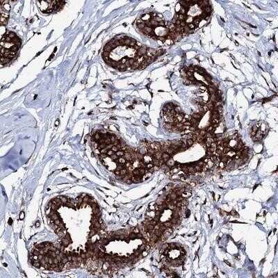 Immunohistochemistry-Paraffin: SPTY2D1 Antibody [NBP2-14502]