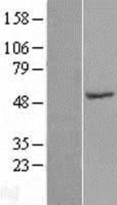 Western Blot: SPZ1 Overexpression Lysate [NBL1-16443]