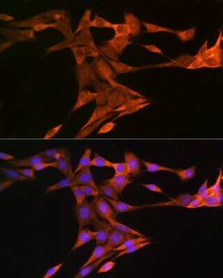 Immunocytochemistry/ Immunofluorescence: SQLE Antibody - Azide and BSA Free [NBP2-93808]