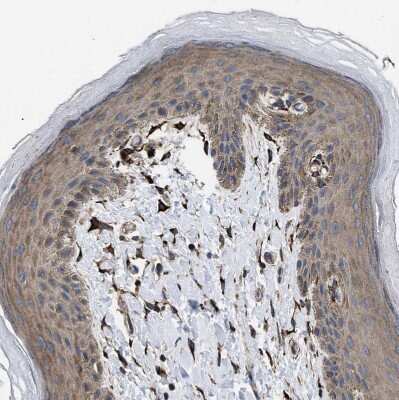 Immunohistochemistry-Paraffin: SQLE Antibody [NBP2-32001]