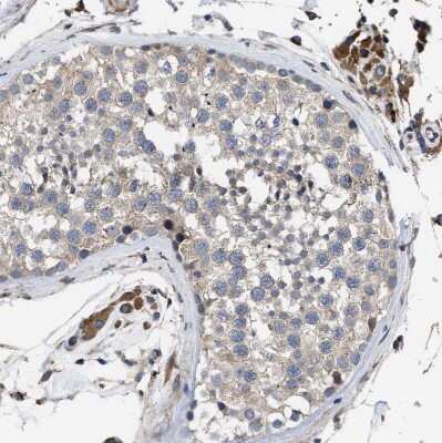 Immunohistochemistry-Paraffin: SQLE Antibody [NBP2-32001]