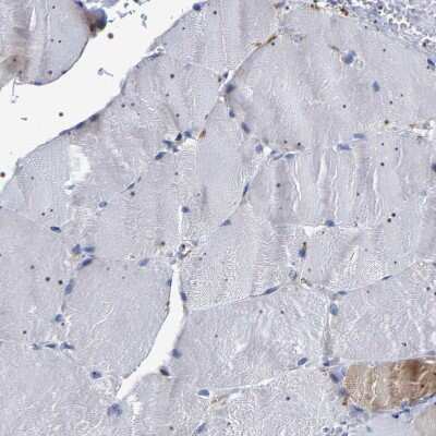 Immunohistochemistry-Paraffin: SQLE Antibody [NBP2-32005]