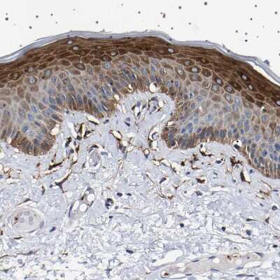 Immunohistochemistry-Paraffin: SQLE Antibody [NBP2-32005]