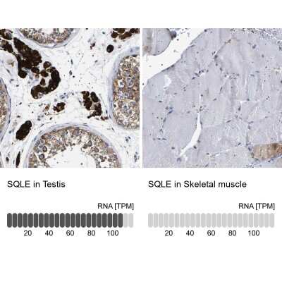 Immunohistochemistry-Paraffin: SQLE Antibody [NBP2-32005]