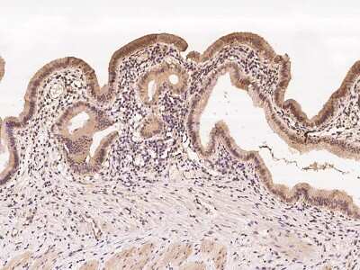 Immunohistochemistry-Paraffin: SQLE Antibody [NBP2-98542]