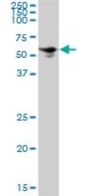 Western Blot: SQLE Antibody [H00006713-B01P]