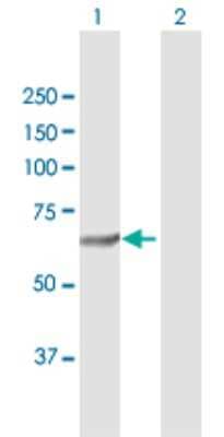 Western Blot: SQLE Antibody [H00006713-D01P]