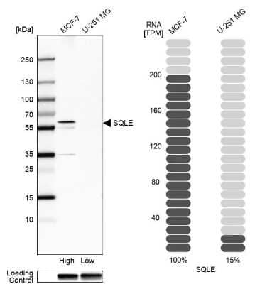 Western Blot: SQLE Antibody [NBP2-32005]