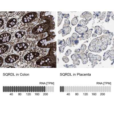 Immunohistochemistry-Paraffin: SQRDL Antibody [NBP1-84510]