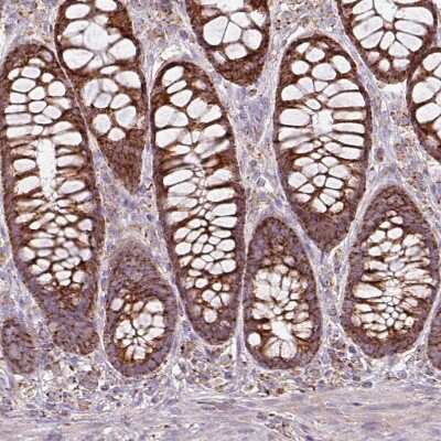 Immunohistochemistry-Paraffin: SQRDL Antibody [NBP2-48742]
