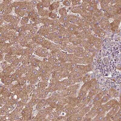 Immunohistochemistry-Paraffin: SQRDL Antibody [NBP2-48742]