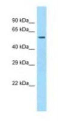 Western Blot: SQRDL Antibody [NBP1-98431]