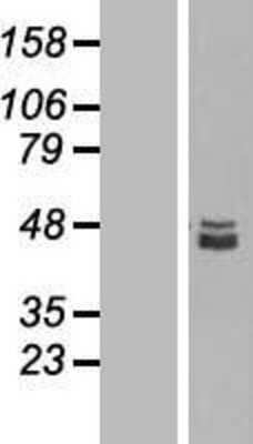 Western Blot: SQRDL Overexpression Lysate [NBL1-16445]