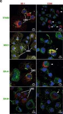 Immunohistochemistry-Frozen: SR-AI/MSR Antibody - BSA Free [NBP1-00092]
