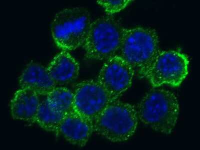 Immunocytochemistry/ Immunofluorescence: SR-AI/MSR Antibody (004) [NBP2-90437]