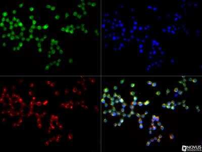 Immunocytochemistry/ Immunofluorescence: SR-AI/MSR Antibody - BSA Free [NBP1-00093]