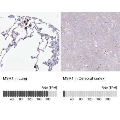 Immunohistochemistry-Paraffin: SR-AI/MSR Antibody [NBP1-88125]