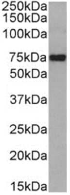 Western Blot: SR-BI Antibody (185-1G2 (B467))ChimericAzide and BSA Free [NBP3-12073]