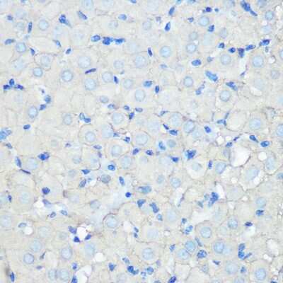 Immunohistochemistry-Paraffin: SR-BI Antibody (1C1I8) [NBP3-15311]