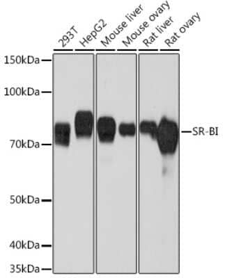 Western Blot: SR-BI Antibody (1C1I8) [NBP3-15311]