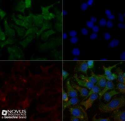 Immunocytochemistry/ Immunofluorescence: SR-BI Antibody - BSA Free [NB400-104]