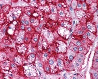 Immunohistochemistry-Paraffin: SR-BI Antibody - BSA Free [NB400-104]