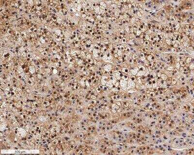 Immunohistochemistry-Paraffin: SR-BI Antibody [NB400-113]
