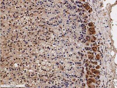 Immunohistochemistry-Paraffin: SR-BI Antibody [NB400-113]