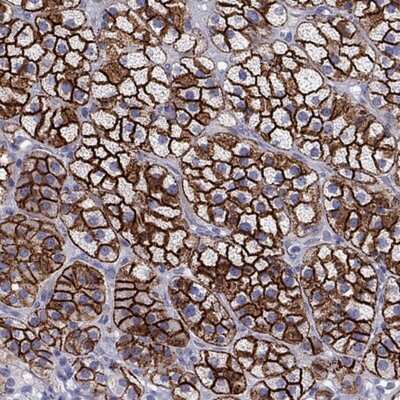 Immunohistochemistry-Paraffin: SR-BI Antibody [NBP2-62676]