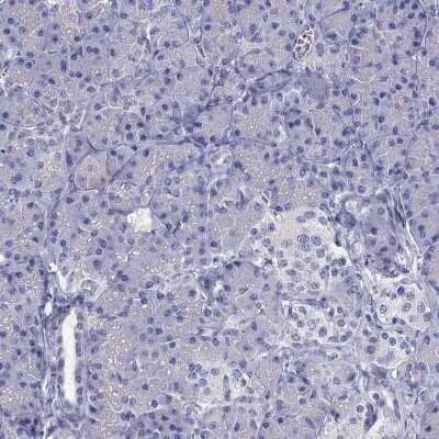 Immunohistochemistry-Paraffin: SR-BI Antibody [NBP2-62676]