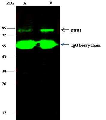 Immunoprecipitation: SR-BI Antibody [NBP2-99690]