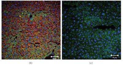 Knockout Validated: SR-BI Antibody - BSA Free [NB400-101]