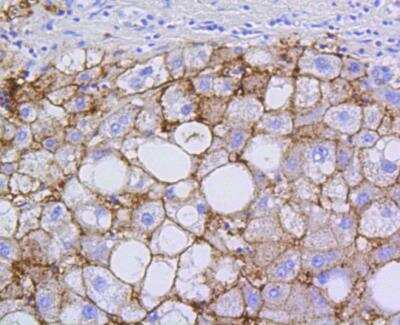 Immunohistochemistry-Paraffin: SR-BI Antibody (SR37-06) [NBP3-11865]