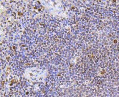 Immunohistochemistry-Paraffin: SR-BI Antibody (SR37-06) [NBP3-11865]