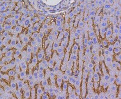 Immunohistochemistry-Paraffin: SR-BI Antibody (SR37-06) [NBP3-11865]