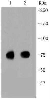 Western Blot: SR-BI Antibody (SR37-06) [NBP3-11865]