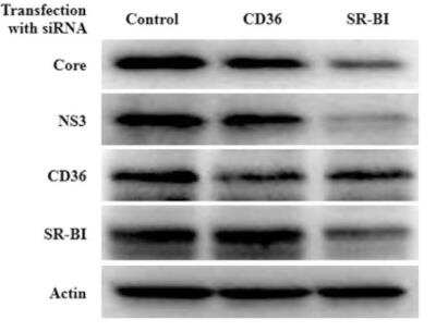 Knockdown Validated: SR-BI Antibody - BSA Free [NB400-104]