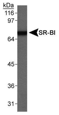 Western Blot: SR-BI Antibody [NB400-113]