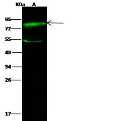 Western Blot: SR-BI Antibody [NBP2-99690]