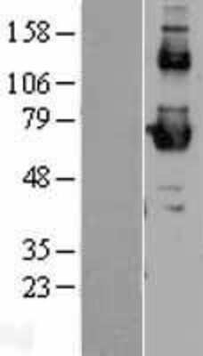 Western Blot: SR-BI Overexpression Lysate [NBL1-15720]