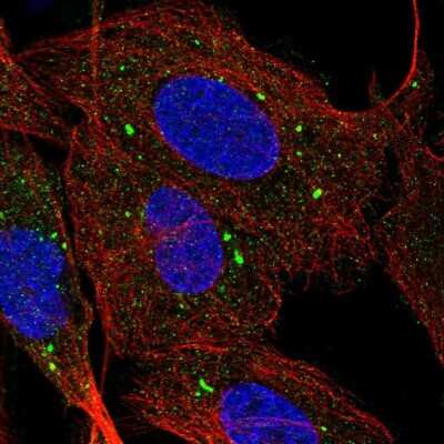 Immunocytochemistry/ Immunofluorescence: SR-BI Antibody [NBP2-54750]