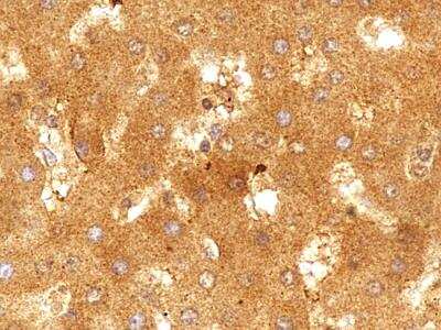 Immunohistochemistry-Paraffin: SR-BI/SR-BII Antibody [NB400-134]